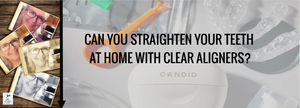 Tooth Talk : Honest Review of Candid Aligners